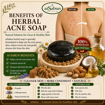 Picture of [100% Natural Handmade Acne Soap] aiSabun Propolis & Lithospermum 100g – Controls Oil, Cleanses Skin & Skin-Friendly