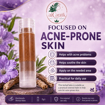 Picture of [Balm] AiCantik Gromwell Root Herbal Balm for Acne-Prone Skin - Easy to Apply, Compact & Practical for Daily Use